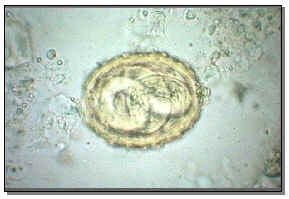 huevo de parásito en heces